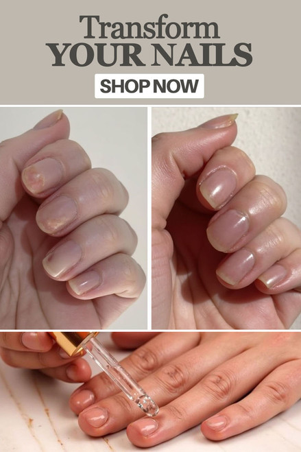 Best Cuticle Serum for Dry Nails - Instant Results: The Complete Guide to Transforming Your Nail Health