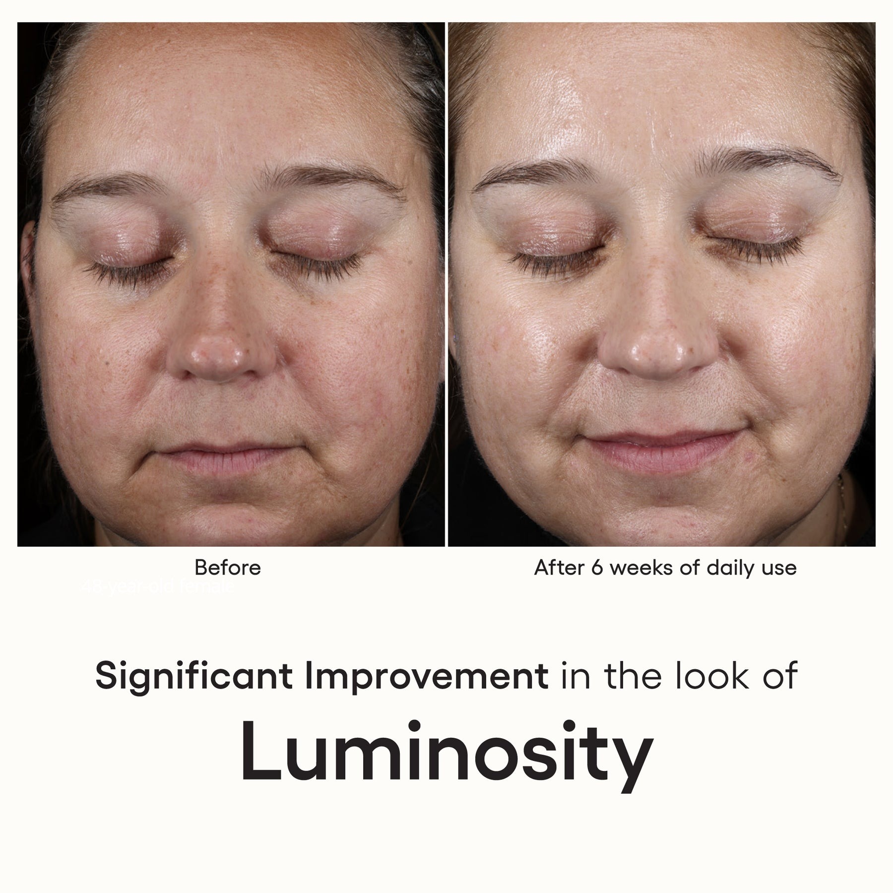 Plated Intense Serum: 6-Week Wrinkle Transformation