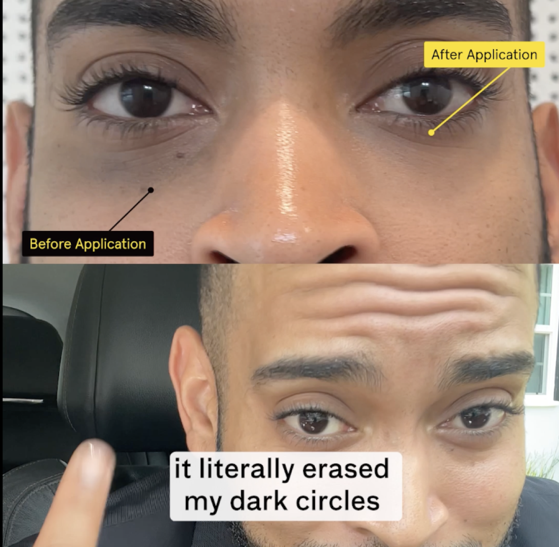 Tinted Under Eye Serum: Instant Dark Circle Coverage