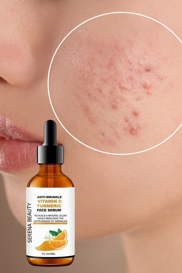 Glow Naturally with Turmeric Serum: Brighten & Renew Skin
