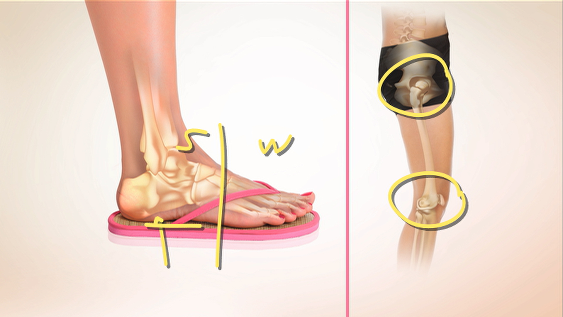 Why Toes Gripping Sandals Could Be Hurting Your Feet