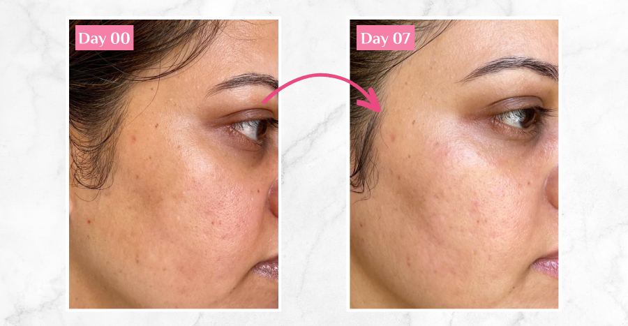 See Real Results: Skin Transformation With Clarins Double Serum