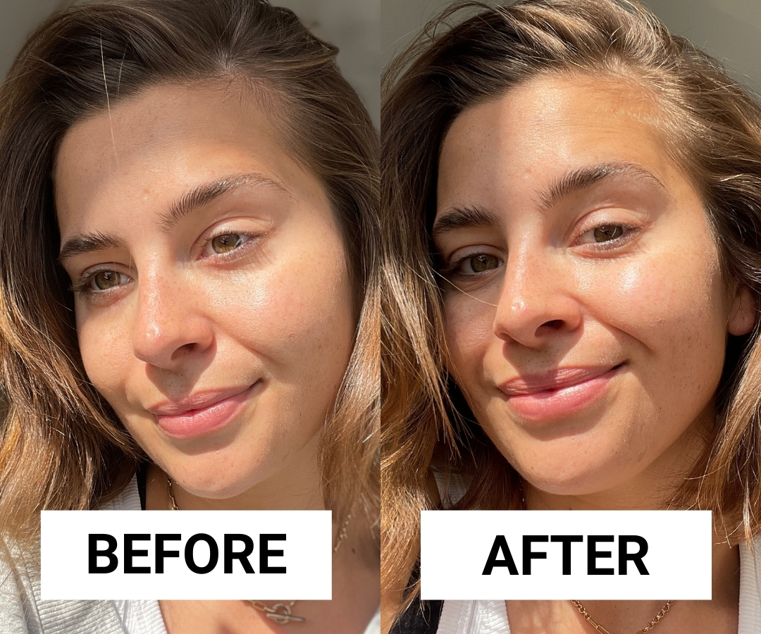 See Real Results: Skin Transformation With Clarins Double Serum