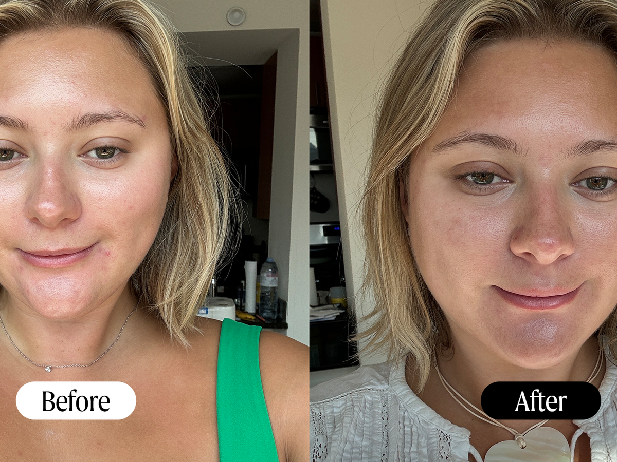 Amazing Rejuvenate Face Serum: 7-Day Glow Results!