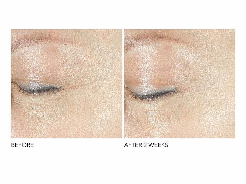 Dr Dennis Gross Retinol Eye Serum Review: Does It Really Work?