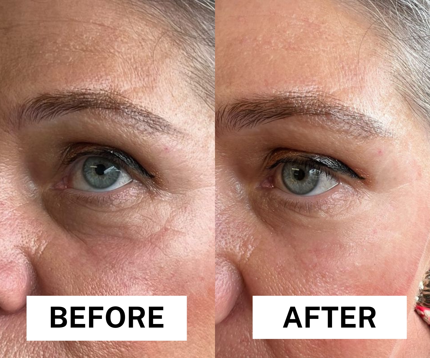 Peter Thomas Roth Eyelash Serum: Real Results & Reviews