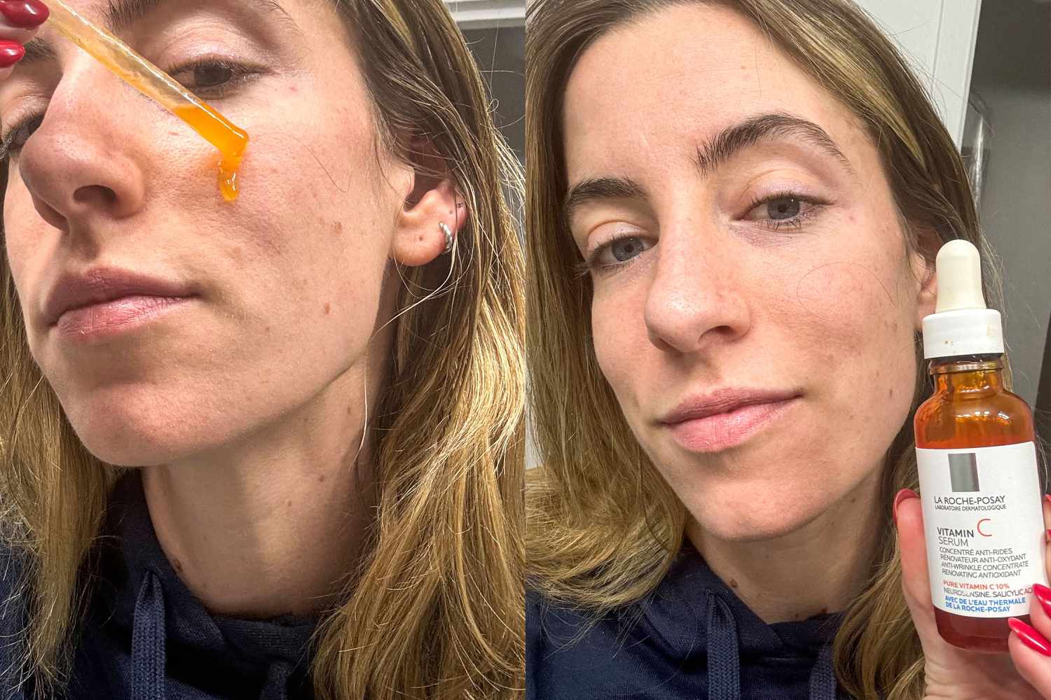 Brightening Vitamin C Serum Before After Dark Spots Gone