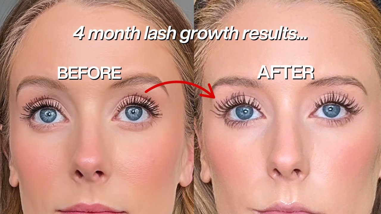 Amazing Sweed Eyelash Growth Serum Results - Before & After