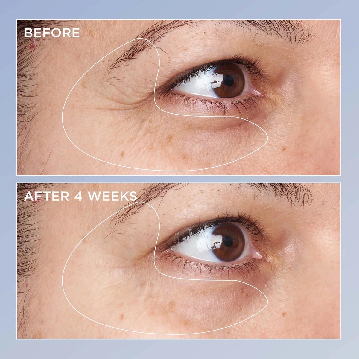 Best Perricone MD Eye Serum Reviews: Worth the Hype?