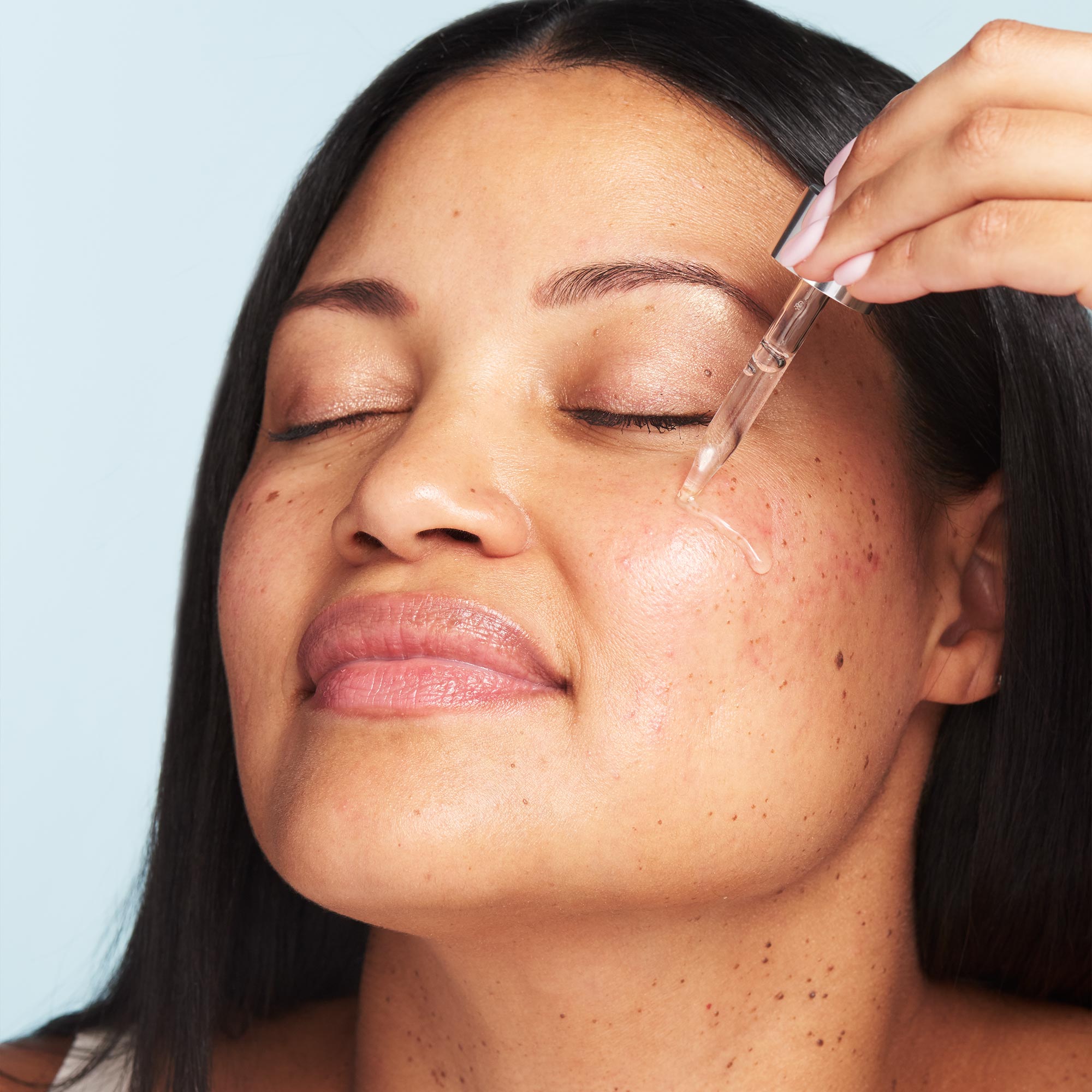 My Perfect Skin Serum: Discover Your Ultimate Glow Now
