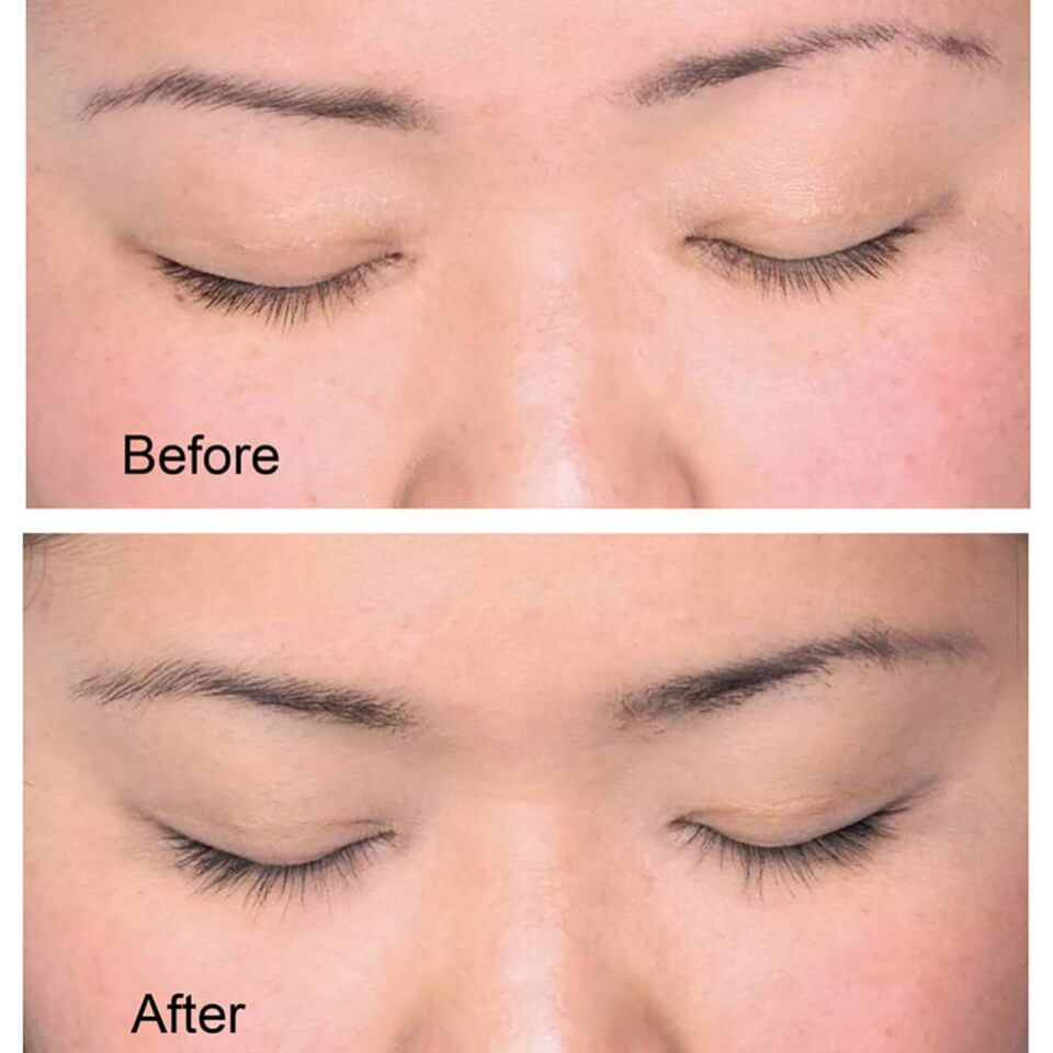 Scandinavian Biolabs Eyelash Growth Serum: Proven Results