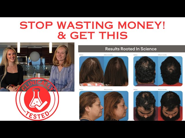 Plated Hair Growth Serum: Unlock Amazing Results Fast