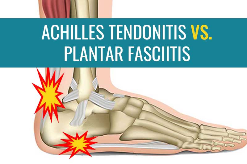 Stiff Feet in Morning? Causes of Heel Pain & Achilles Tendinitis Explained