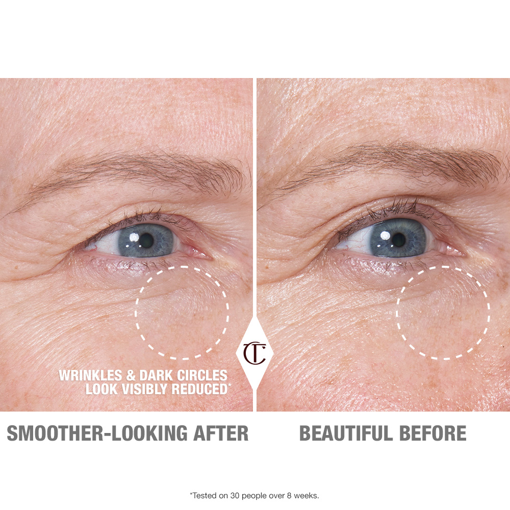 What Is Eye Serum? 5 Shocking Benefits You Must Know