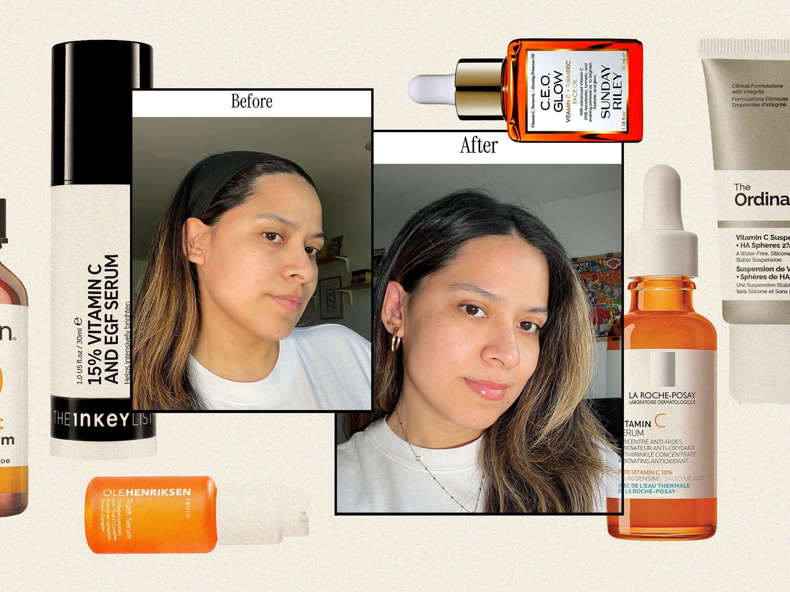 Best Skin Tightening Serum for Face and Neck: Top Picks 2025