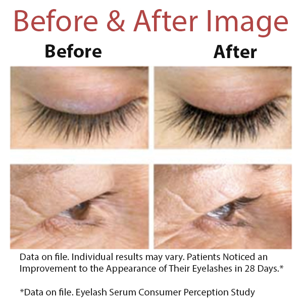 Top-Rated Alpha Lash Serum for Eyelash Growth & Volume Boost
