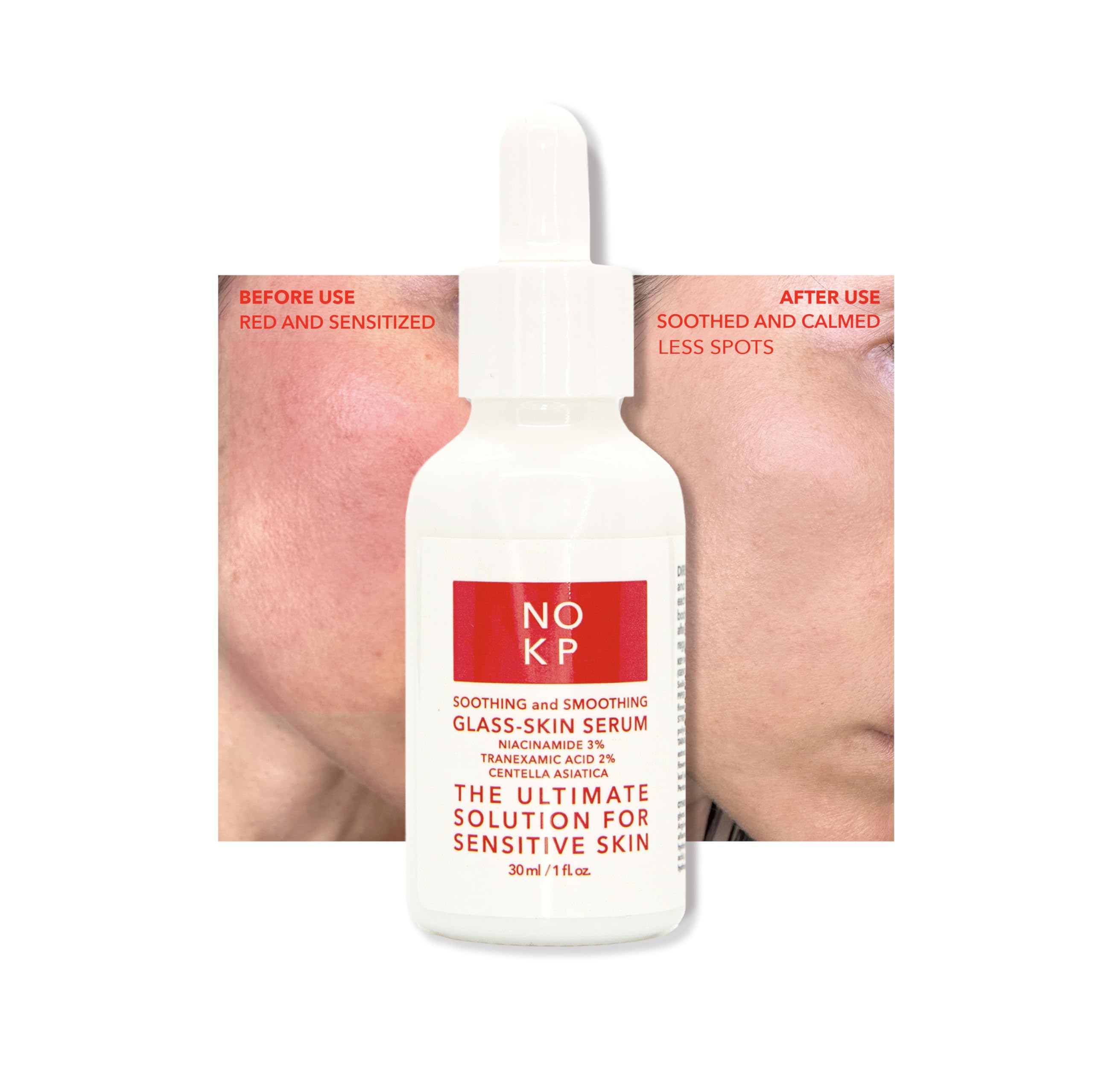 Best Serum for Red Sensitive Skin That Actually Works
