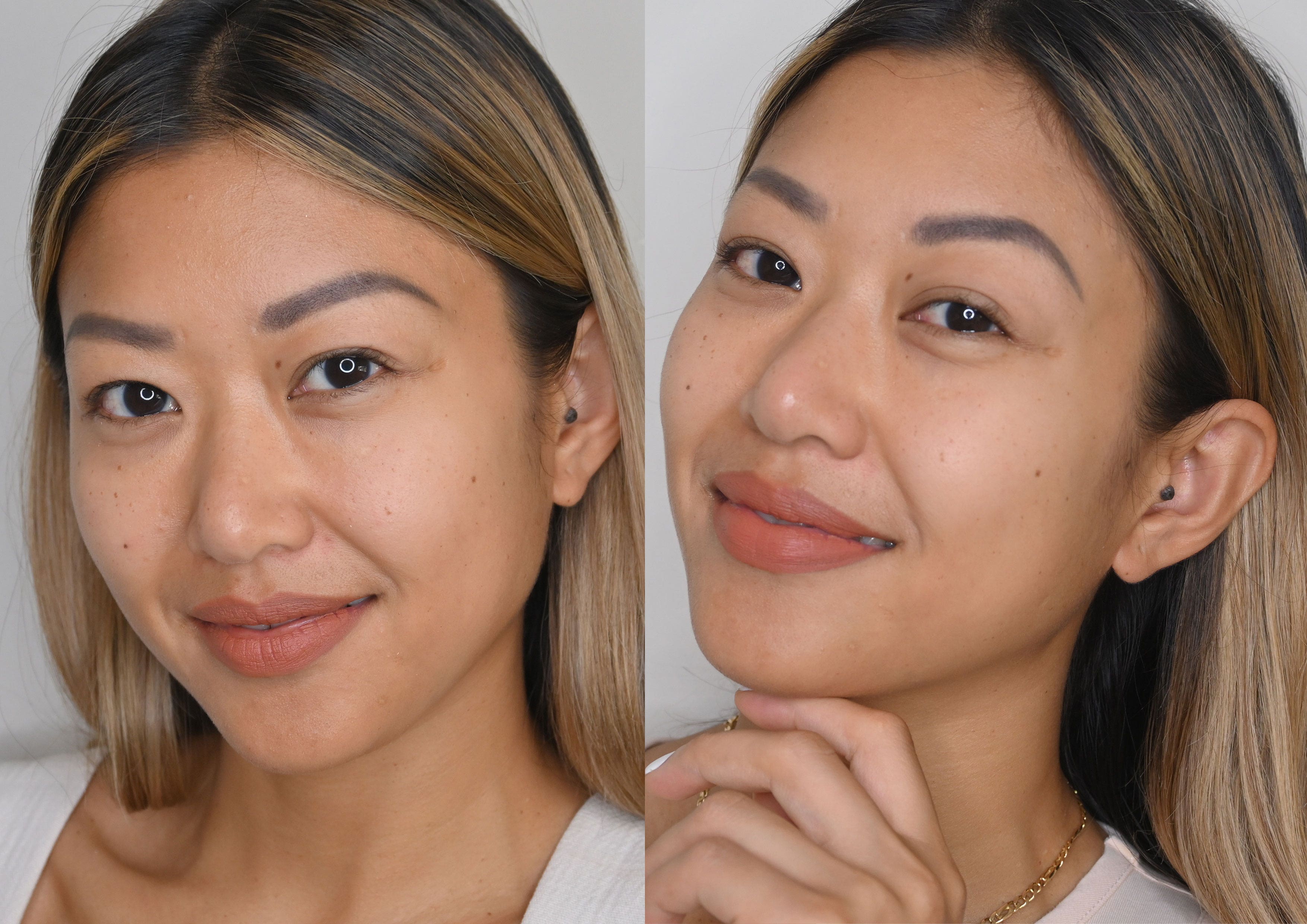 Hyaluronic Acid Serum Before After Results You Need to See