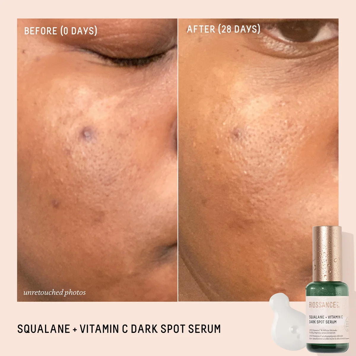 Brightening Vitamin C Serum Before After Dark Spots Gone