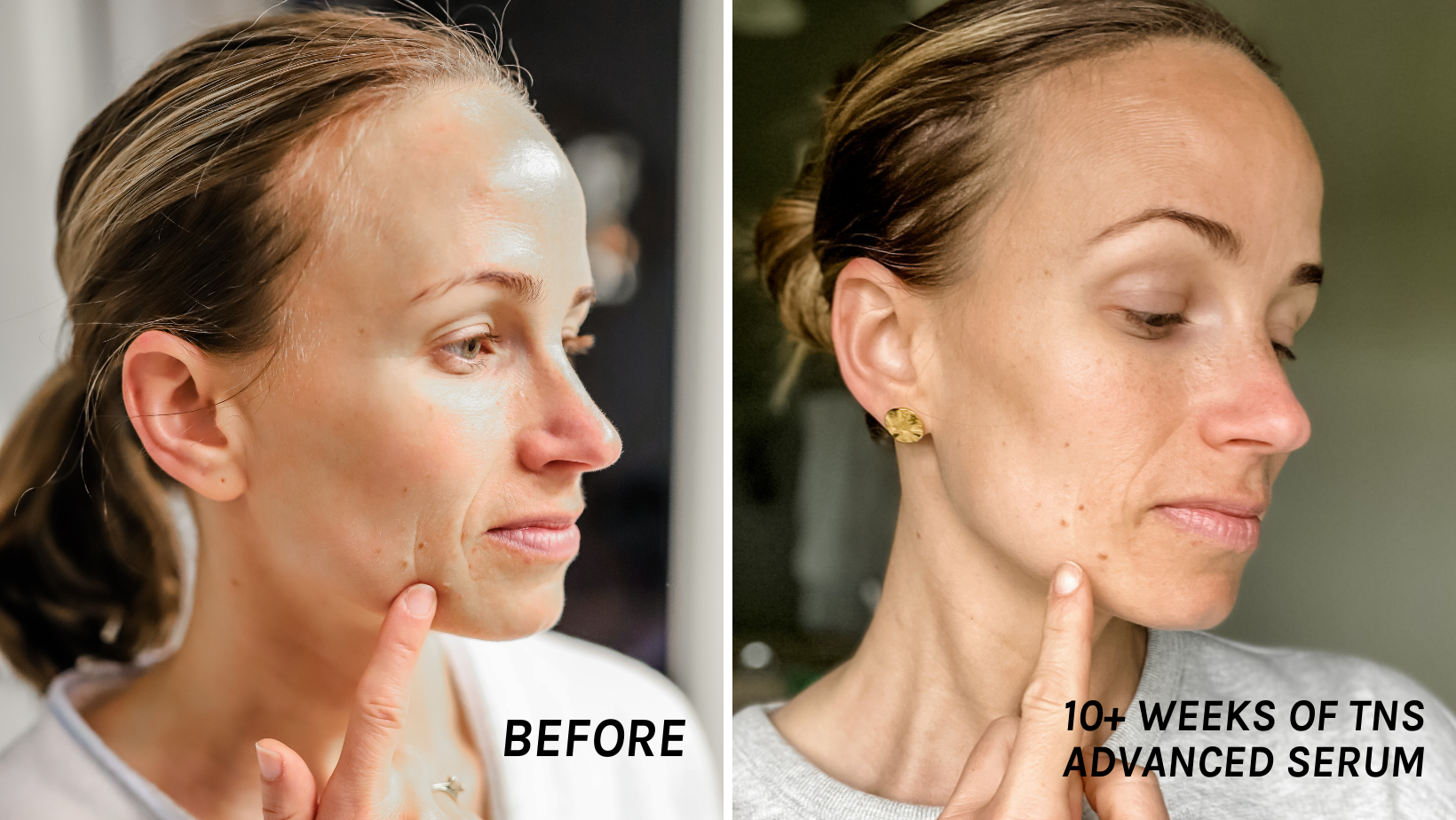 Is TNS Advanced Serum Worth It? Honest Review & Results