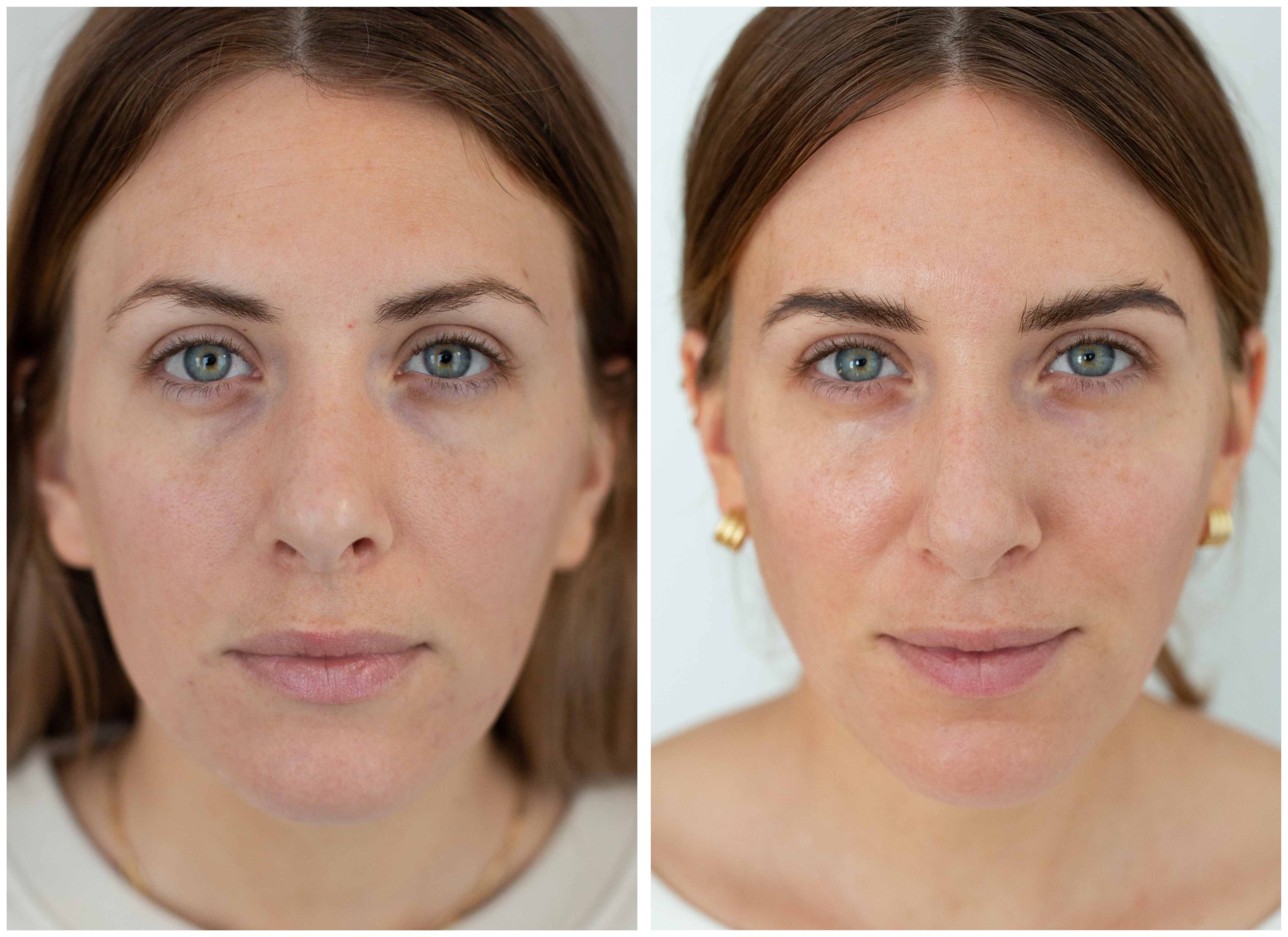 Roc Wrinkle Serum Reviews: Does It Really Work?