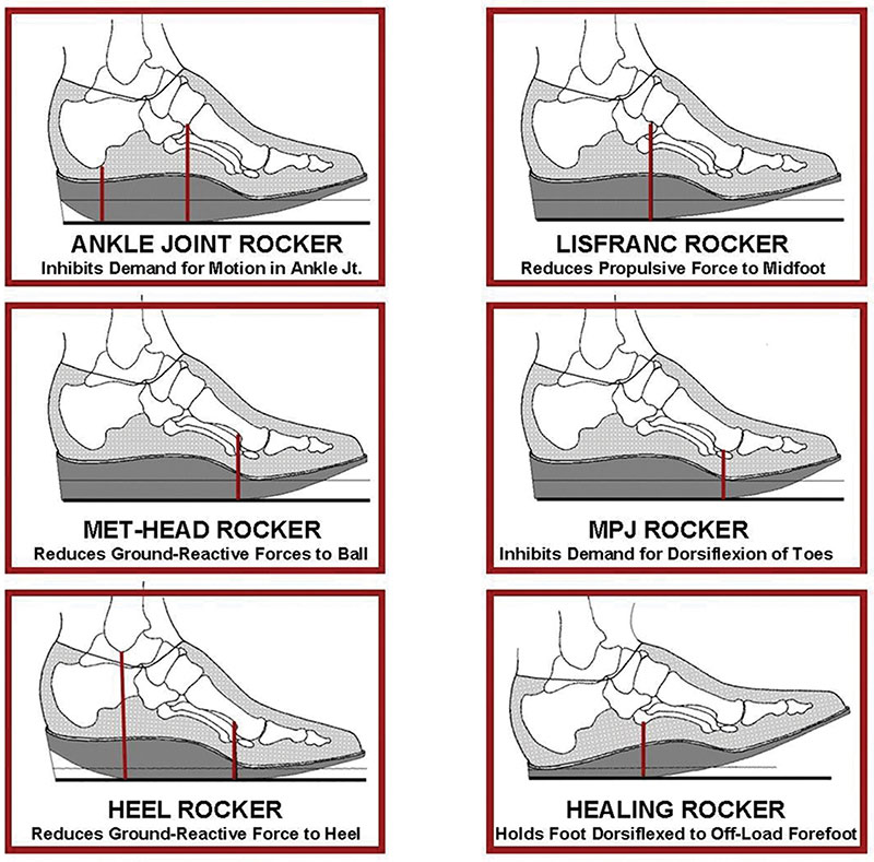 What Are Rocker Shoes? Benefits & How They Work Explained