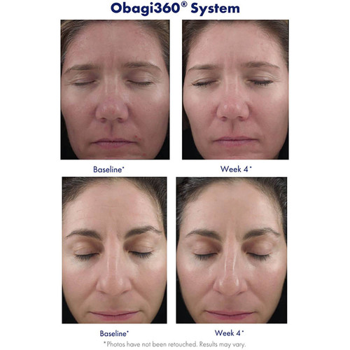 Obagi Retinol Reviews: Real Results & Honest Opinions