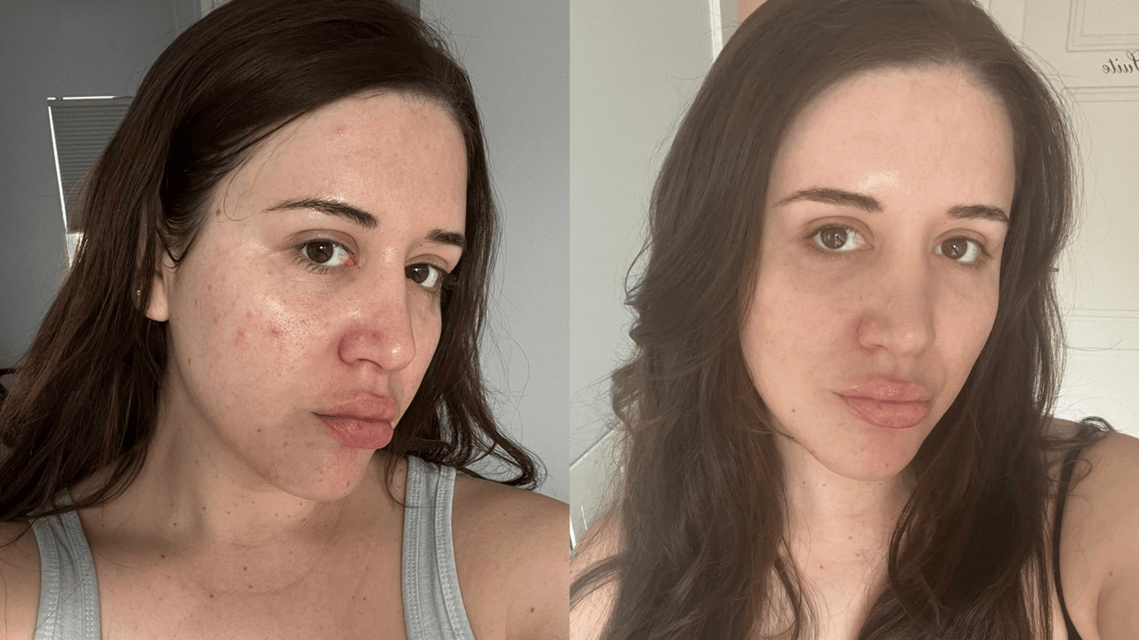 Tatcha Serum Review: Does It Really Work?