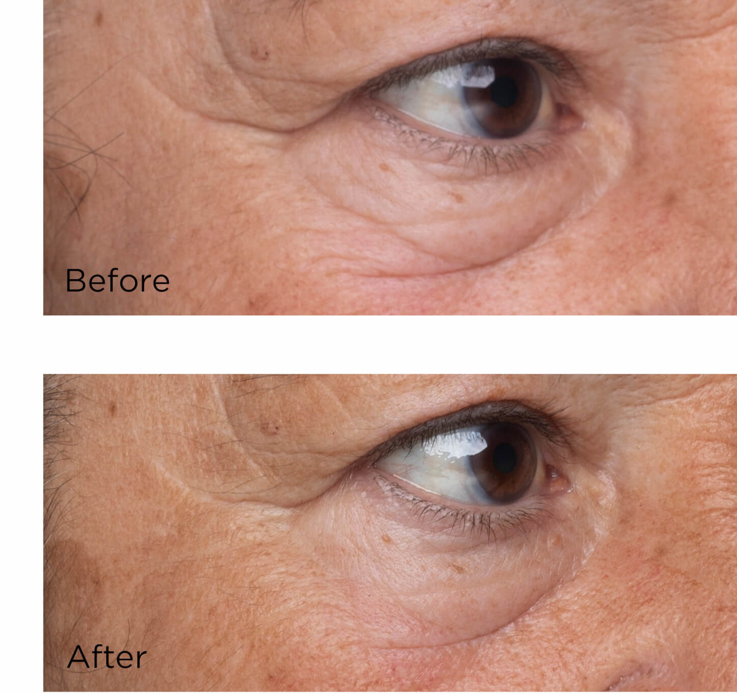 Perricone Eye Serum Results: Your Complete Transformation Timeline