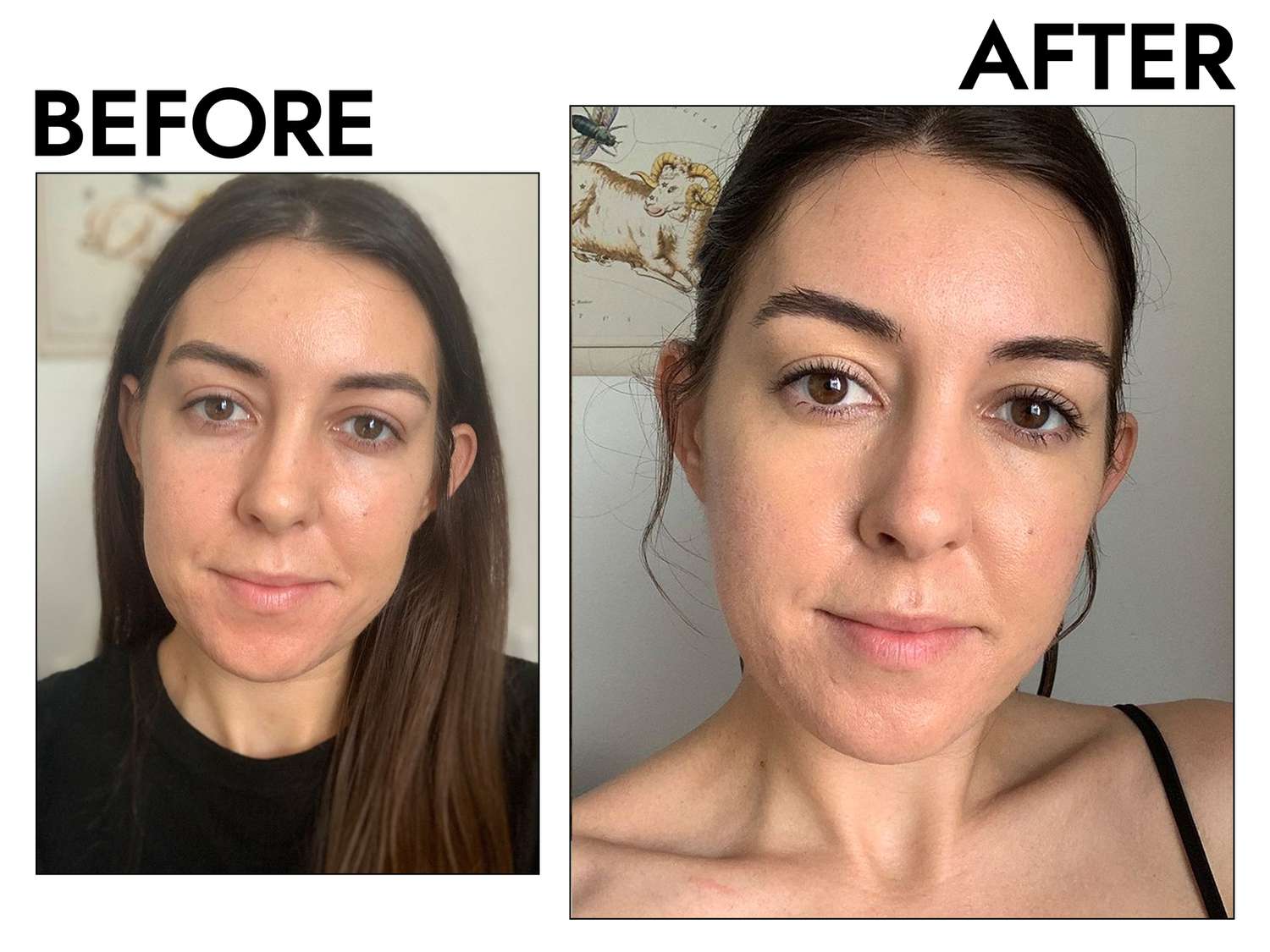 5 Best Eye Circles Serums That Actually Work in 2025