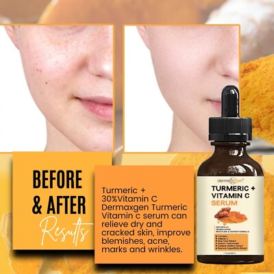 Best Tumeric Serum for Dark Spots - Get Clear Skin Fast!