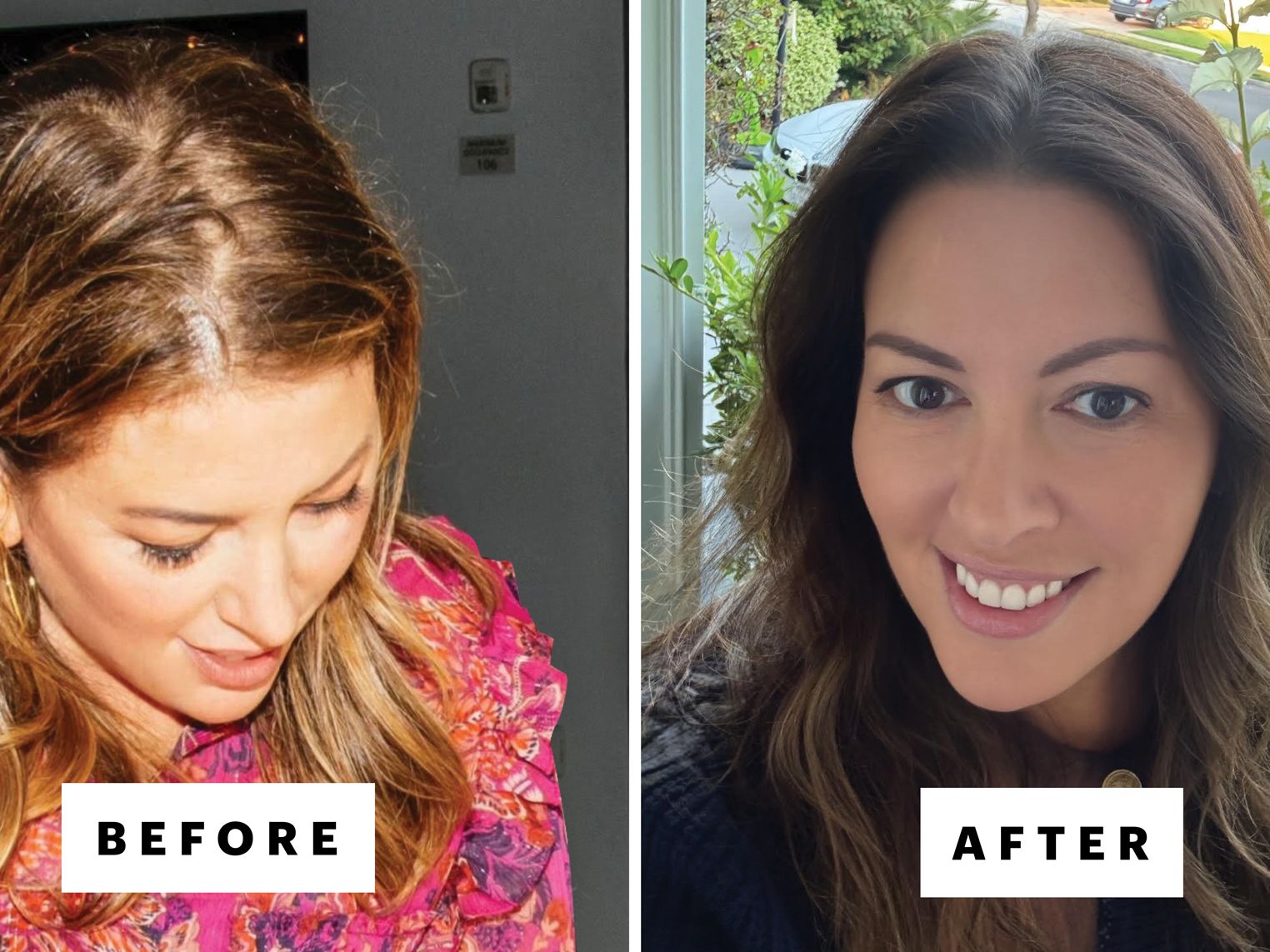 Claire Serum Review: Before & After Results Will Shock You