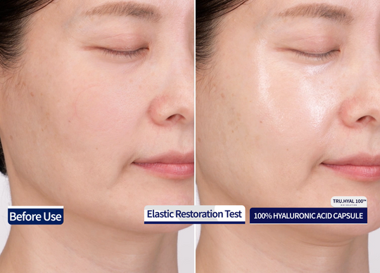 30-Day Before and After Hyaluronic Acid Serum Test