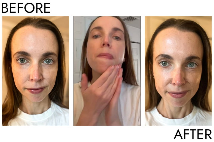 Dark Spots Fade Fast with Dermatologist Asta C Serum