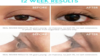 Collagen Eyelash Serum: Get 3x Longer Lashes in 4 Weeks