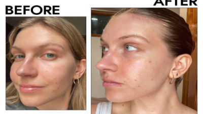 Biore Cleanser Review: Does It Really Transform Your Skin?