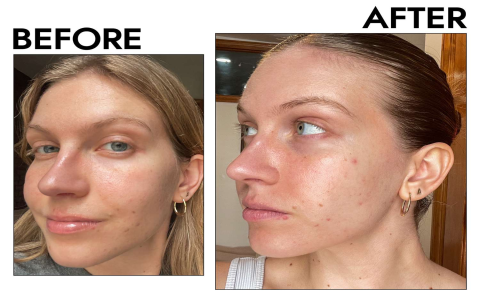 Biore Cleanser Review: Does It Really Transform Your Skin?