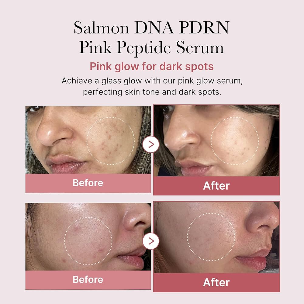PDRN Serum Benefits: 5 Ways It Transforms Your Skin