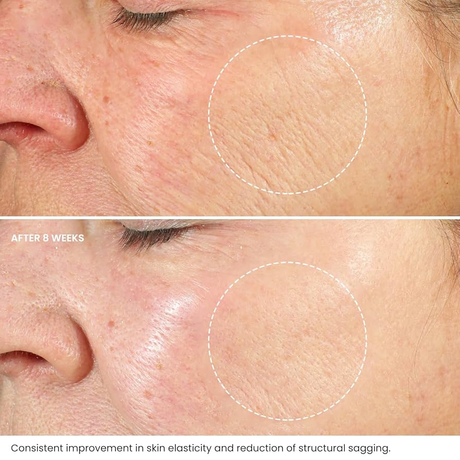 Beste Anti Rimpel Serum - Verminder Rimpels in 30 Dagen