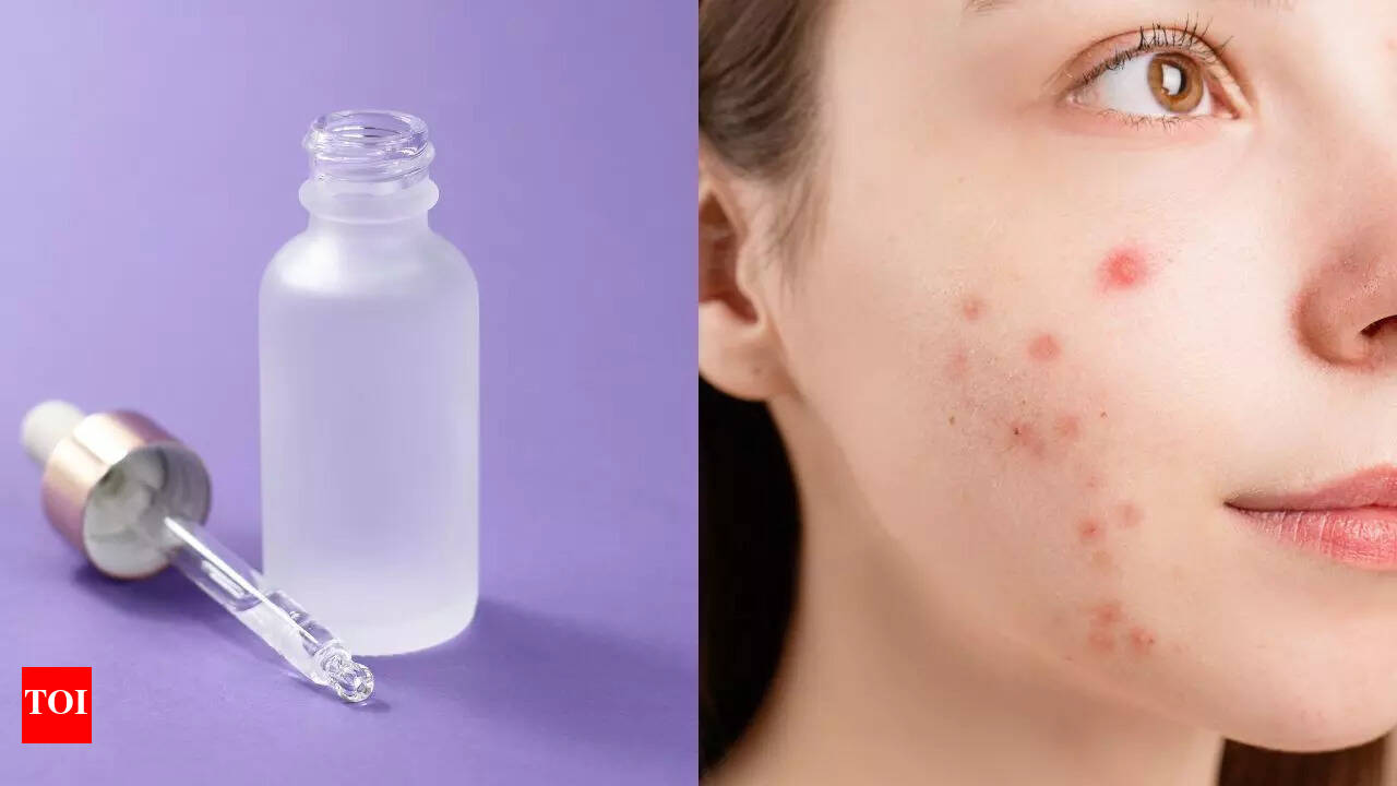 7 Game-Changing Benefits of Salicylic Acid Serum