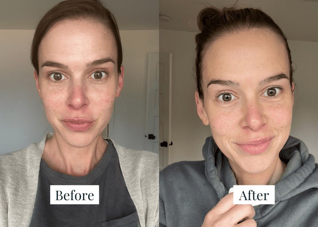 Wave Serum Review: Does It Really Work?