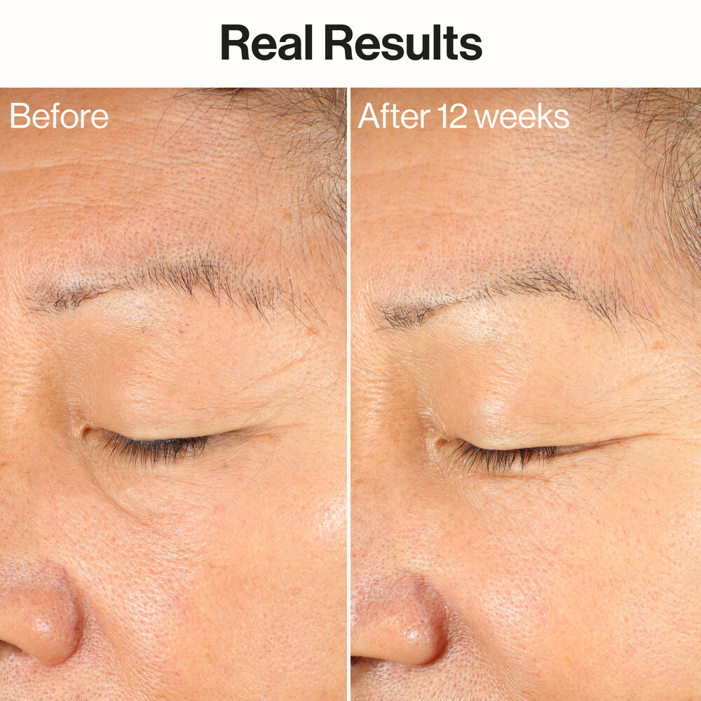 Her Serum Review: Does It Really Work? Honest Results