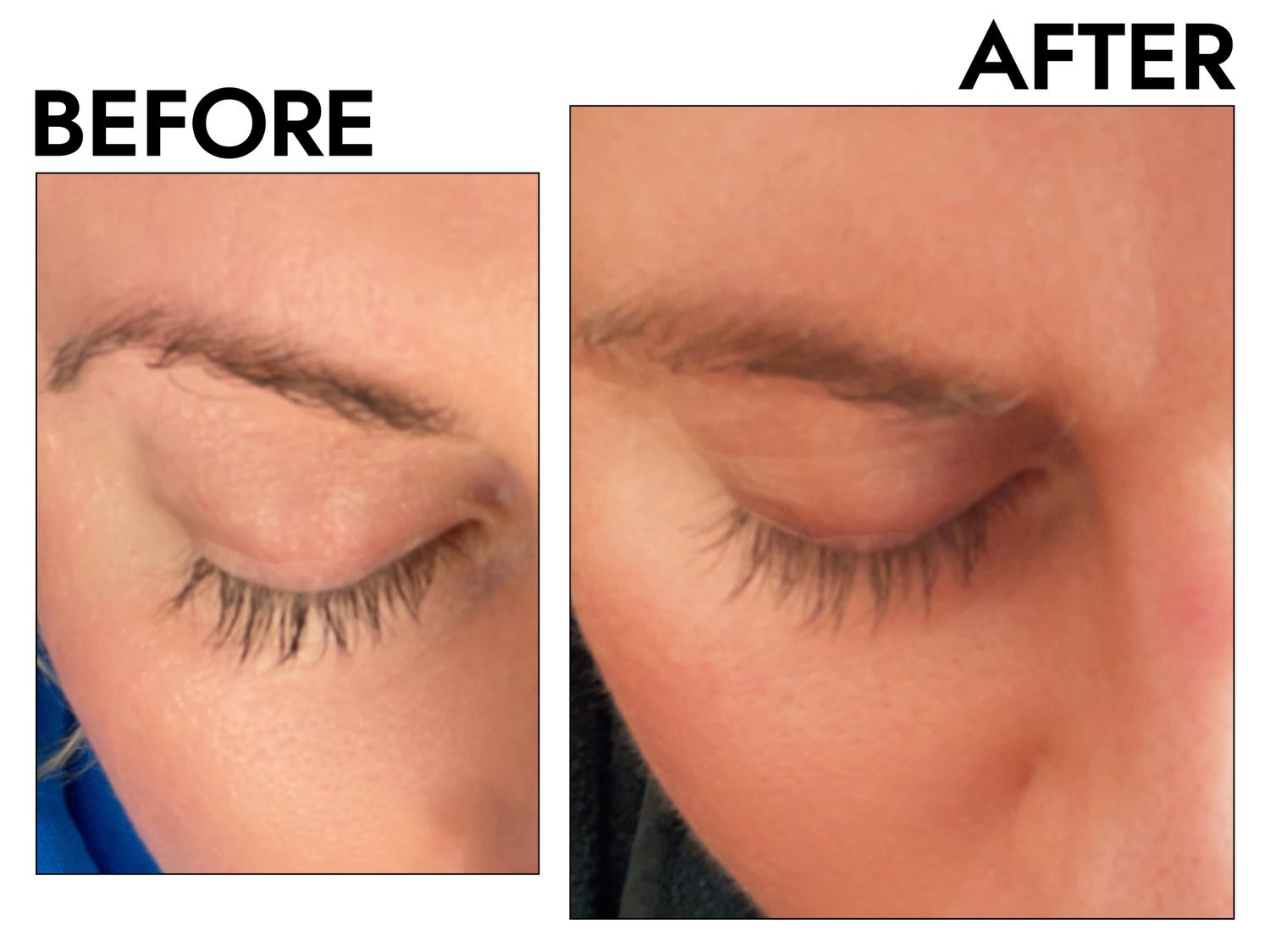Does Lash Growth Serum Work? 2025 Dermatologist Says
