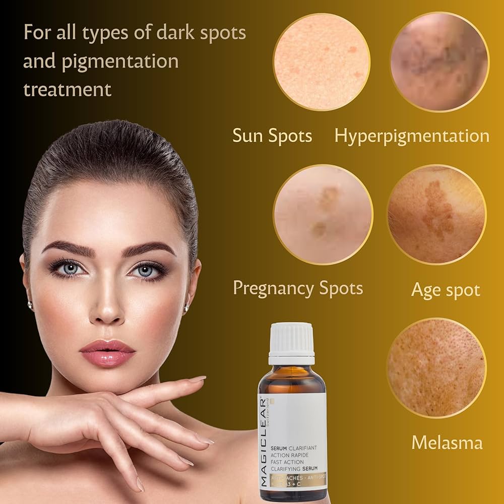 Dark Spots Vanish: Way of Will Brightening Serum Works!