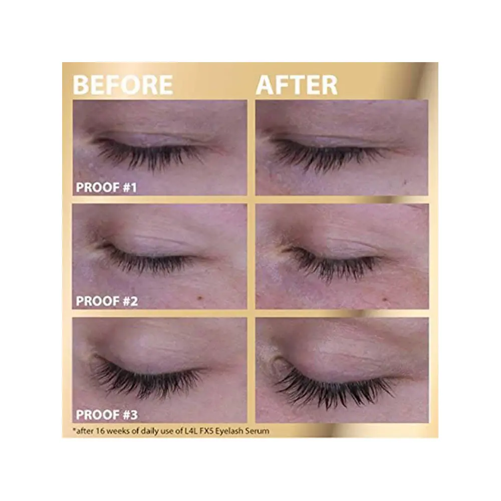 Royal Lashes Serum: Get 3X Longer Lashes in 4 Weeks!