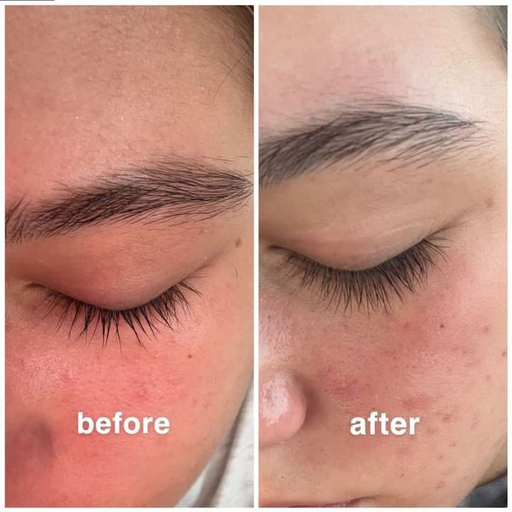 NuOrganic Serum Review: Shocking Before & After Photos