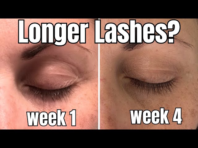 This Wimperserum Gave Me 2x Longer Lashes in 4 Weeks