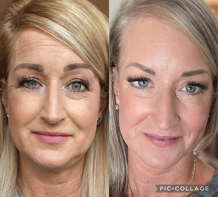 Youthology Serum Before & After: Shocking Results