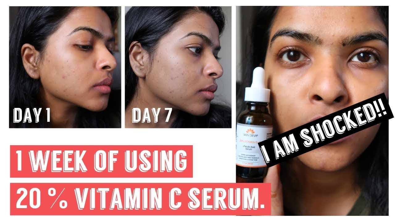 Vitamin C Serum For Face Before And After: Shocking Results!