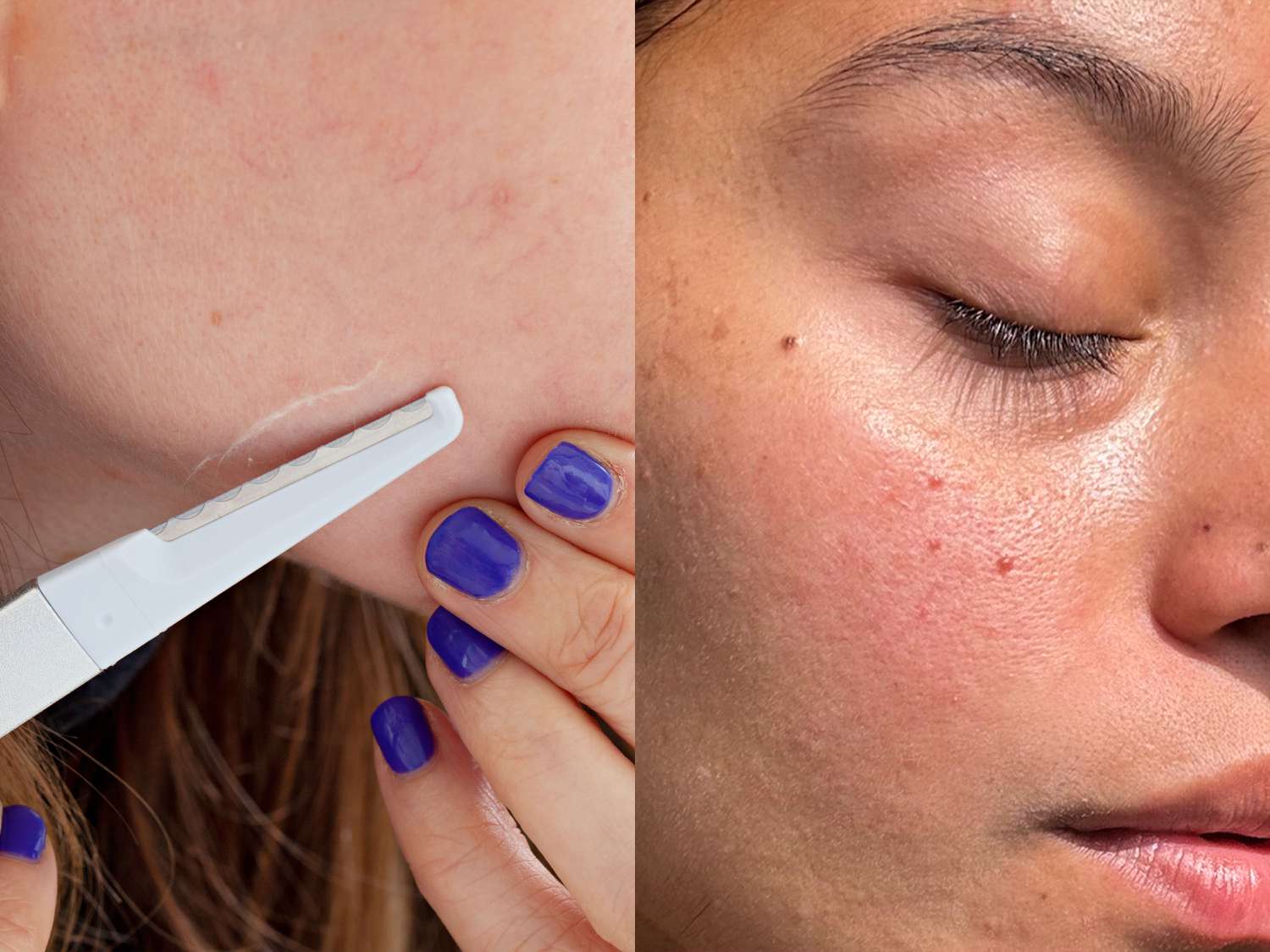 Best Dermaplane Serum for Instant Glow (2025)